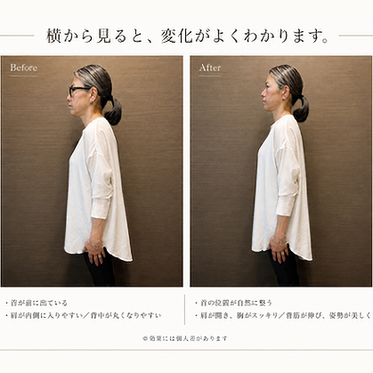 施術前後の比較